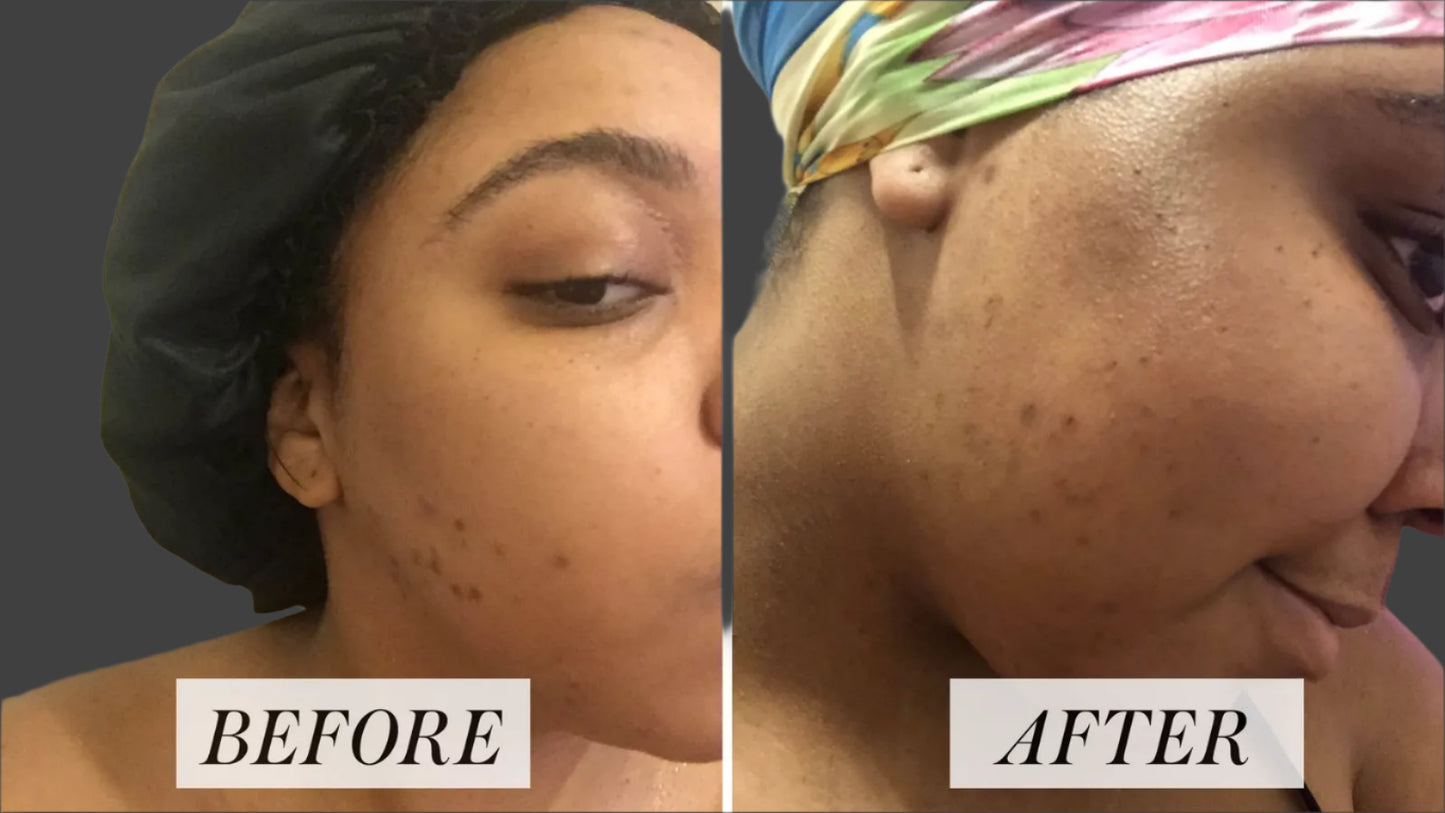 COSRX Snail Mucin Serum